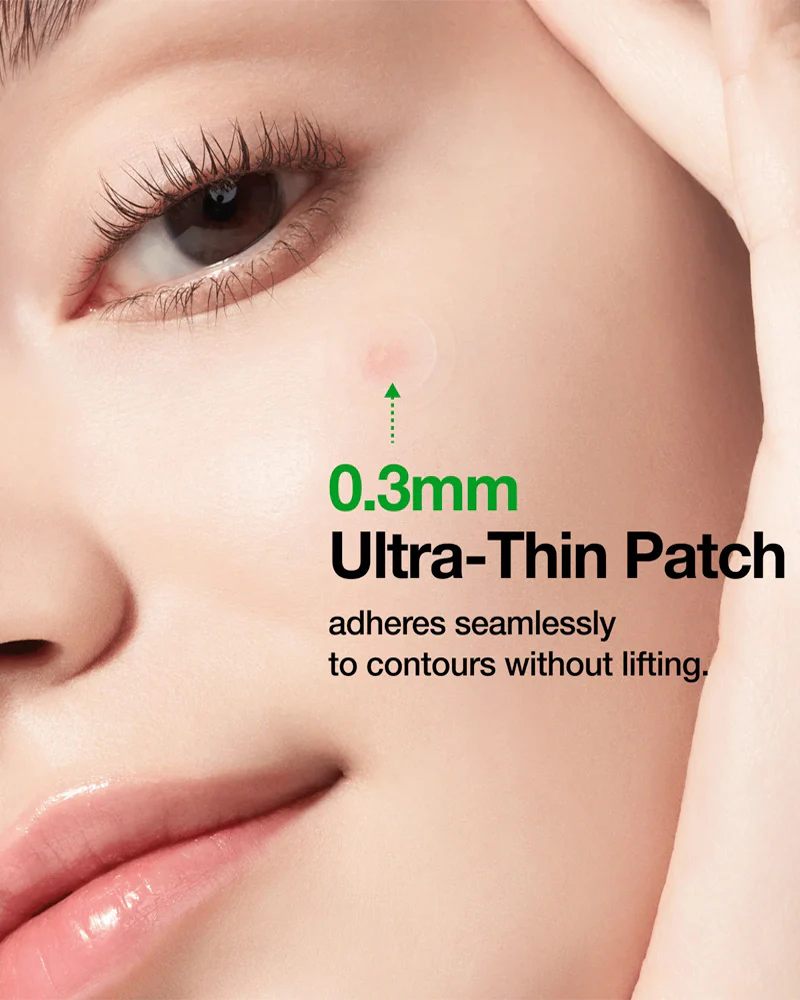 Anua Triple Acid Spot Care Microdart Patch - Image 4