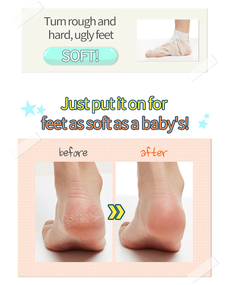 A'pieu Soft Foot 30Minute Peeling Socks - Image 3