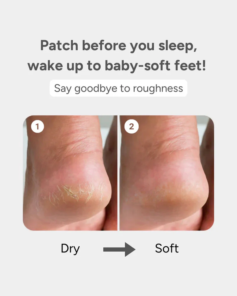 baren Shea Butter Sleeping Heel Patch - Image 6