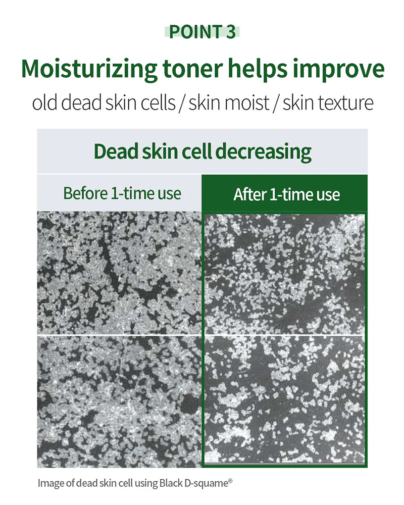 Benton Aloe BHA Skin Toner (Renewal) - Image 8