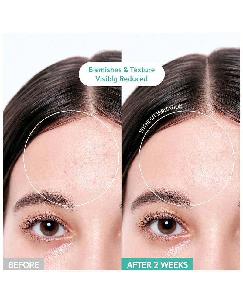 BRING GREEN Tea Tree Cica Soothing Toner - Image 4