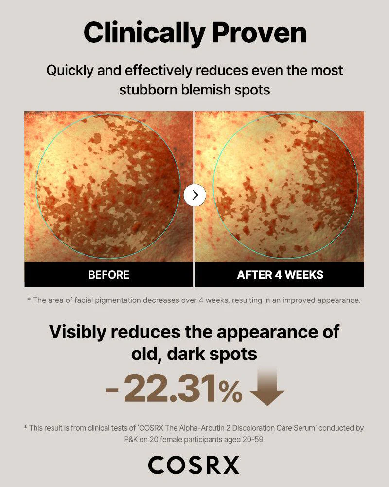 COSRX The Alpha-Arbutin 2 Discoloration Serum 50 mL - Image 7