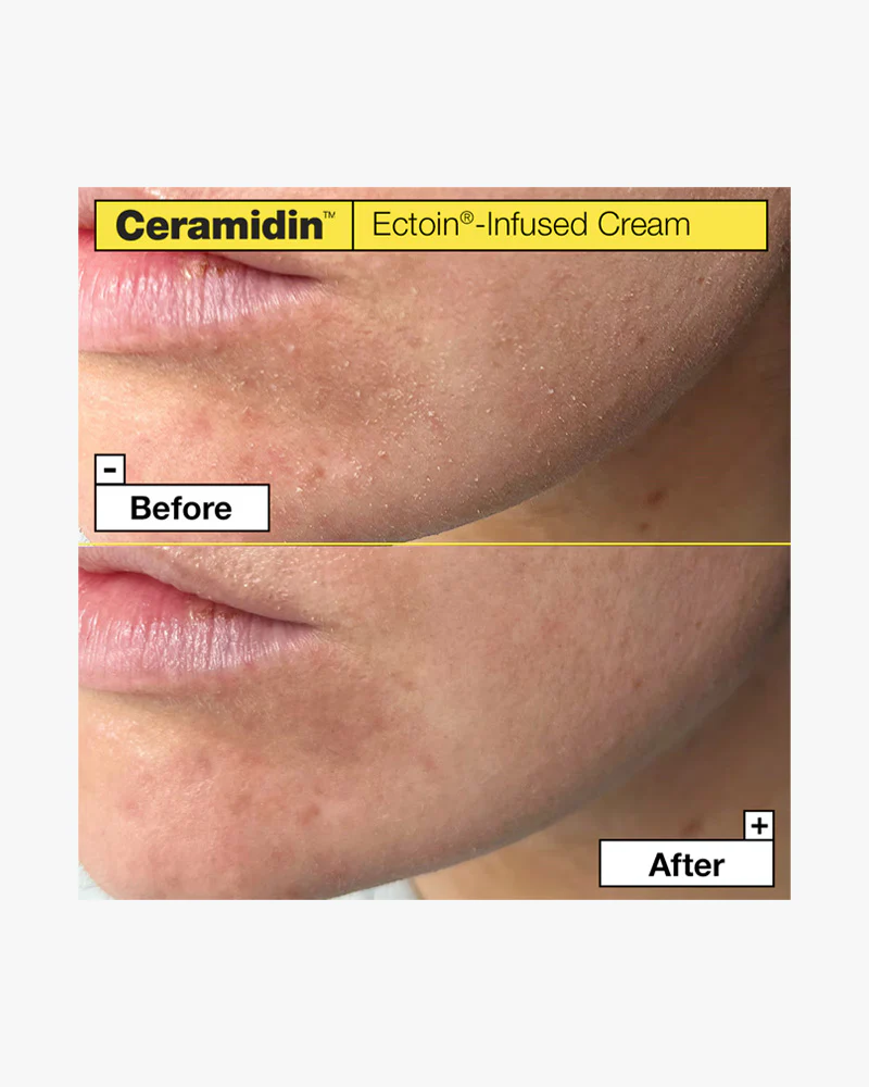 Dr.Jart Ceramidin™ Ectoin® Infused Cream - Image 4
