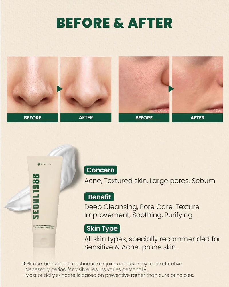 K-SECRET SEOUL 1988 Cleansing Foam Pine Cica 1% + Probiotics - Image 6