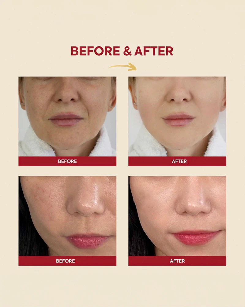 K-SECRET SEOUL 1988 Essence: Snail Mucin 97% + Rice - Image 4