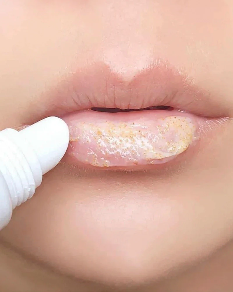 MEDIHEAL Pantenolips Scrub - Image 2