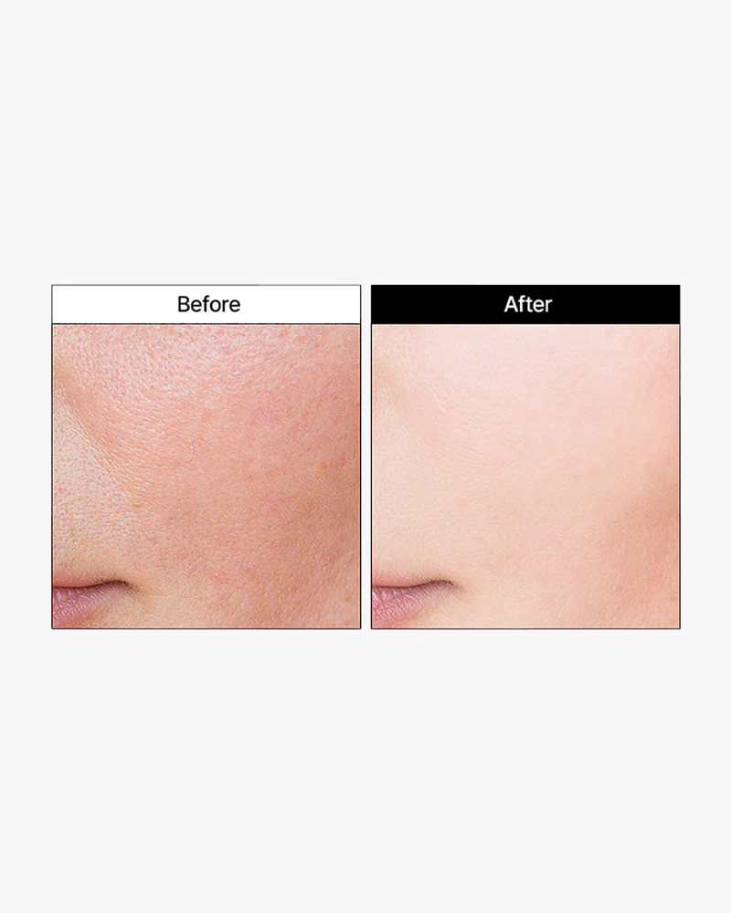 MEDI-PEEL Phyto Cica-Nol B5 Wrapping Mask - Image 4