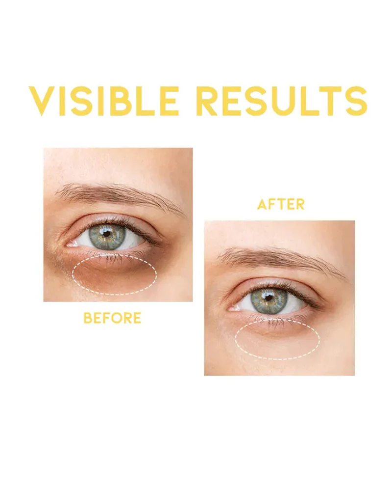 #OOTD Dark Circle Eye Serum - Image 4