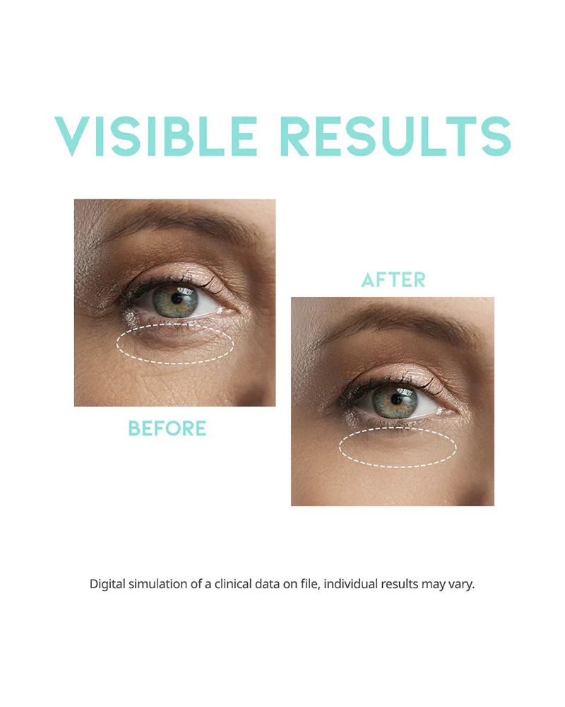 #OOTD Wrinkle Lift Eye Serum - Image 4