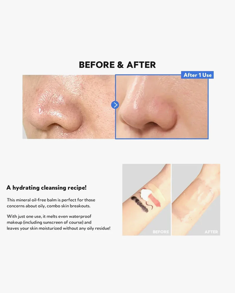 Tirtir Hydro Boost Enzyme Cleansing Balm - Image 5