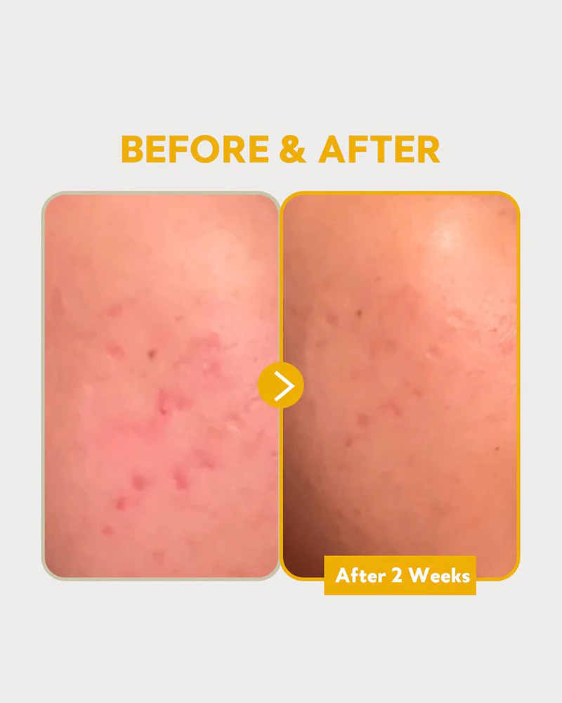 TIRTIR Pure Vitamin C24 Serum - Image 7